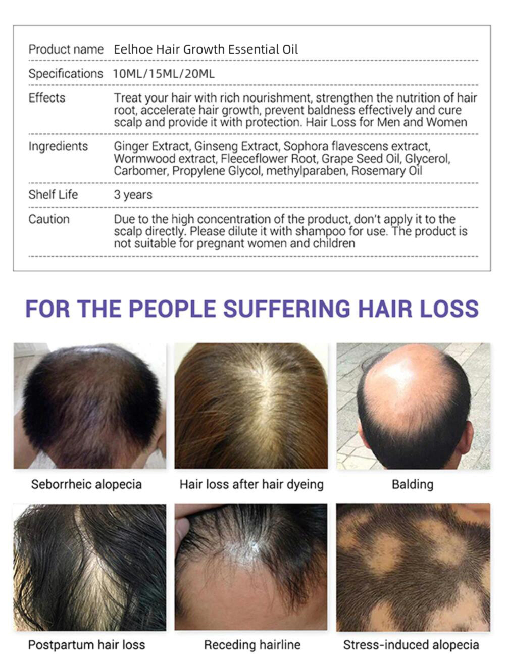 Ginger products for fast growing hair growth
Essential Hair Oil