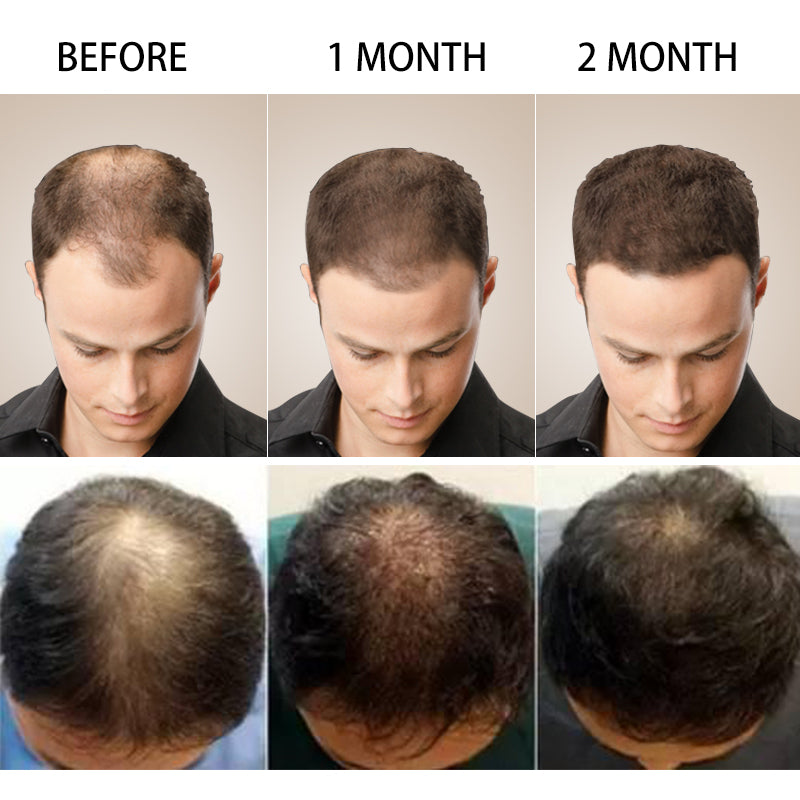 Ginger products for fast growing hair growth
Essential Hair Oil
